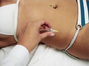 tratamiento carboxiterapia guayaquil