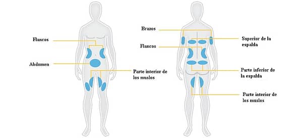 grasa localizada